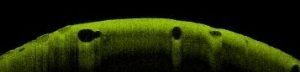 Rabbit heart – 2D cross-section of external bottom Rabbit heart aortic valve – 2D cross-section